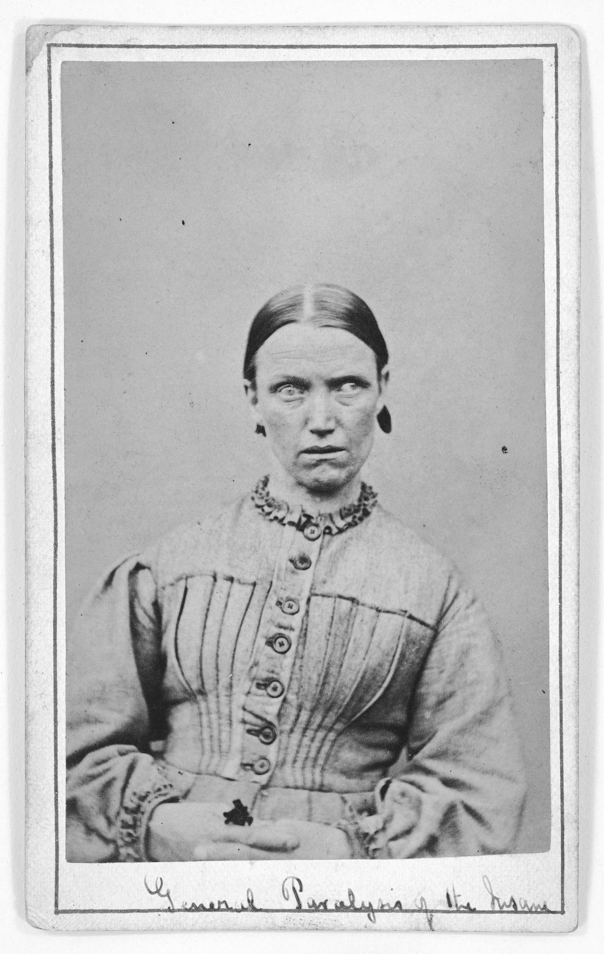 L0019063 Woman suffering from general paralysis; c. 1869