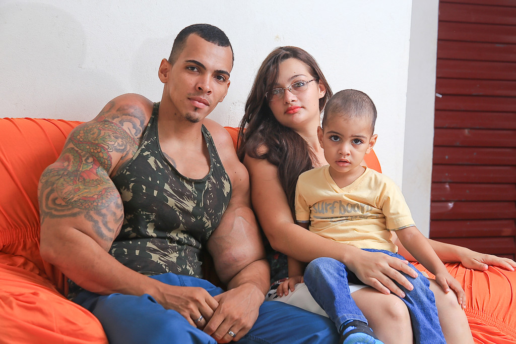 Muscle Injections Almost Cost This Man His Arms - Brazil